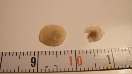 Discinisca  nigrolineata
